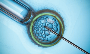 试管婴儿胚胎植入前遗传学诊断技术研究进展