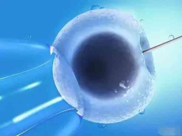 试管婴儿胚胎植入前遗传学诊断